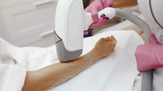 successful laser hair removal steps 6